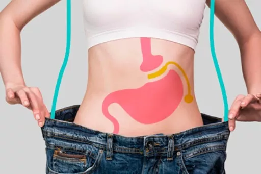 Bariátrica: la cirugía que no solo transforma tu cuerpo, también tu mente y tu vida